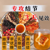 夏枯草蒲公英散结茶消除甲状腺结节乳腺结节淋巴甲亢肺结节茶磨玻璃微小结节结茶中药材消结茶散结汤30包 古方 一盒 30包体验装