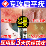 ASTACURE疣体脱落膏去疣膏旗舰店医用快速去疣体100%特效药克点痣点疣药水