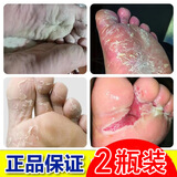 余氏堂足康一号脚气喷剂脚臭喷雾脱皮脚汗水泡型脚痒薬足鞋脚丫真菌糜烂 【喷剂2盒装】