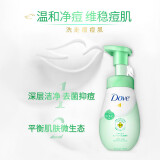 多芬(Dove)抗痘洗面奶150ml 深层清洁 舒缓痘痘肌 维稳修护敏感肌适用