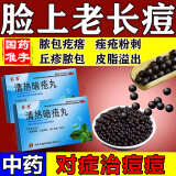 解毒清热痤疮丸 祛痘消炎痤疮专用药口服 脸上去痘痘的药青春痘去闭口粉刺红肿硬块皮肤用药 清热暗疮丸 1盒【粉刺痘痘 轻微长】