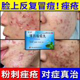 清热解毒痤疮i丸 消炎痤疮专用药口服脸上去痘痘的药 粉刺闭口青春痘脓疱疮皮肤用药 清热暗疮丸 1盒【痘痘粉刺 轻微长】