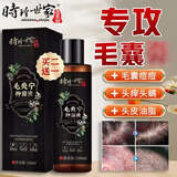 时珍世家 金系列【官方直售】李时珍世家毛炎宁洗发水夫密码液去屑止痒毛囊洗发水 【一瓶体验装】150ml/瓶