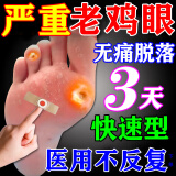 鸡眼贴去看看根去肉刺刺猴无痛脱落连根跖拔疣脚底趾疣去根除老茧硬皮软膏水杨酸苯酚贴软膏主图视觉特效 1盒装【顽固老鸡眼】100%国药