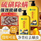 国药精养硫磺皂除螨沐浴露去螨虫后背痘痘控油鸡皮角质液皂淋浴400ML*2瓶