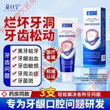 益口宁医用口腔防蛀膏龋齿封闭牙齿窝沟点间隙阻断细菌提高牙齿釉质耐酸蚀性男女通用牙膏 1盒【体验装】