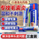 香港大药房有限公司毛囊炎膏去屑止痒头痒脂溢性头部严重专用特起疙瘩效非藥三盒