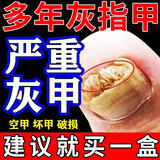 灰指甲根药正治品灰指甲药膏坏指甲真菌感染脱甲去看灰指甲 硝酸咪康唑乳膏【主图视觉特效 成人专用】 单盒