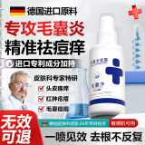 BEAI毛囊炎头皮长痘痘非药膏特止痒抑菌效除螨净喷剂非洗发水 30ml