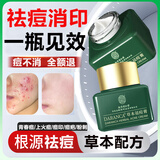 同仁堂祛痘膏去痘疤淡化痘印痘坑修复呵护痘肌亮肤青春痘20g七夕