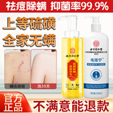 同仁堂硫磺除螨毛炎宁洗发水沐浴露套装毛囊炎去屑止痒持久留香