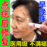 点痣后修复膏防疤痕点痣祛i疤痕凹坑去红印专用修复脸部激光术后点斑专用生长因子凝胶液 单盒装(已售99+)
