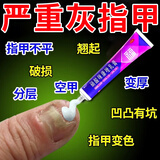 灰指甲根药正治品灰指甲药膏坏指甲真菌感染脱甲去看灰指甲 硝酸咪康唑乳膏【主图视觉特效 成人专用】 2盒【疗程装】