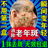 莱览奥盖祛斑霜美白淡化老年黄褐雀斑黑色素晒斑去祛斑男女士专用医用正品 特效;一盒装【强力祛除】 老人斑脸部手背效果最好的产品非中药水一夜消