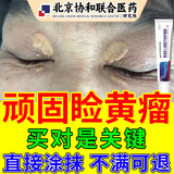 DR.AVIN睑黄瘤专用膏去睑黄疣去脂肪粒睑黄瘤专用眼部黄色斑块药监备案GT 单盒装【睑黄瘤专研】