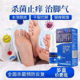 修正 唯达宁 硝酸益康唑喷雾剂30ml 脚气药止痒脱皮烂脚丫脚气喷剂 用于治疗足癣体癣花斑癣