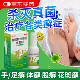 伊人 盐酸特比萘芬喷雾剂15ml:0.15g*15ml 用于治疗手癣足癣体癣股癣及花斑癣等