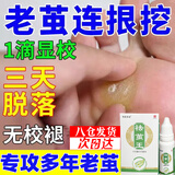 欣盛佳园去脚底老茧去硬皮专用软化剂老茧软化膏茧子去除神器祛茧王抗菌液 祛茧王 一瓶