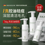 SKISGEM德国进口除螨虫祛痘痘印洗面奶去黑头收毛孔粉刺氨基酸控油男女士 【第三件0元】洗面奶囤货120ml*3