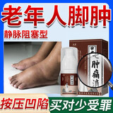 高康老年人脚肿专用喷剂可搭脚肿消肿药老人水肿消肿浮肿用什么药好MT 1盒【标准装】老年人水肿专用