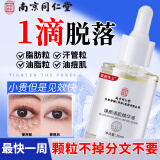南京同仁堂脂肪粒去除神器汗管粒油脂粒颗粒清肌精华液眼霜补水保湿男女30ml 1瓶30ml