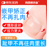 杨四郎药业嵌甲甲沟炎矫正器正甲贴片/套指甲长肉里嵌甲矫正器贴片趾甲专用