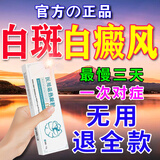 乔记白癜风遮盖液神器白斑皮肤病修复膏白癜风专用非药促进黑色素生长 308(100%发货特效)1盒装【无买赠试用】 白癜风遮盖液100%成功去除白斑消白(非进口)软膏