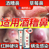 示博士酒糟鼻草莓鼻红肿玫瑰痤疮红鼻子专用去粉刺黑头红血丝螨虫修护软 三盒周期装（中度型） 搭红鼻子酒糟鼻头红肿消炎产品用