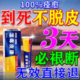 千草本原手脱皮严重脱皮真菌蜕皮干燥起皮儿童手指足脚脱皮抑菌开皲裂药膏 一盒特效装【一抹止脱皮】