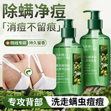 dyey青花椒净肤止痒沐浴露男女除螨杀菌祛痘去角质持久留香沐浴液