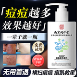 同仁堂氨基酸洗面奶祛痘水杨酸净螨收缩毛孔黑头烟酰胺深层清洁面乳200g