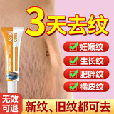 ASTACURE进口防妊娠纹油孕期妊娠纹修复霜预防孕妇专用淡化肥胖纹生长纹油