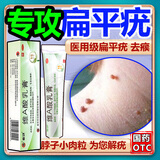 维A酸乳膏去疣体特新效期药扁平疣专用药去疣类药膏去脖子小肉粒颈部瘊子去尤瘊小肉粒去疣膏瘊子肉刺肉粒 1盒装【国药准字脱疣瘊】 瘊子去除国药准字药膏  放心购买 安心售后