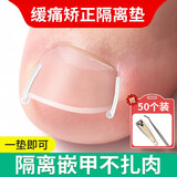 甲沟炎矫正脚指甲矫正修正器隔离填充垫片脚趾甲长在肉里修剪神器 甲沟隔离垫20个 送剔甲器1根+指甲剪1个