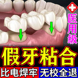 奕康本草粘牙胶水医用假牙粘合剂粘结稳固修复金属烤瓷牙强力进口保丽净 升级版【进口材料】送四个工具