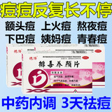 内分泌失调痘痘内调排毒养颜祛痘内调祛痘消炎痤疮专用内服治疗豆脸上的痘痘粉刺疙瘩中药皮肤用药排毒养颜片 1盒【祛痘内调口服药】