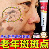 维a酸乳膏0.1角化异常引起老年斑脸部手背祛斑点斑专用OTC药霜水去老人斑老年斑专用OTC药一皮夜消 1盒装【老年斑专用OTC药】