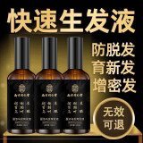 南京同仁堂防脱育发液精华防脱发男女士专用快速增生长增发喷雾剂发际线正品 买2送1【中度脱发疗程】