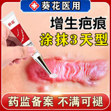 葵花疤痕灵增生凸起去除疙瘩修复止痒除疤膏止痒医用烧伤烫伤疤凝胶 1盒装【体验装】 去疤痕修复凝胶医院专用祛疤膏儿童新旧疤痕灵去除增生