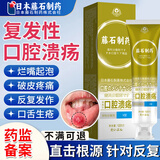 【日本监制】口腔溃疡专用可搭牙膏口舌生疮上火疼痛嘴巴溃烂口腔反复溃疡烂起泡破皮牙龈肿疼痛促进愈合HW 【两盒优惠装】第二盒伴价【上火起泡 溃疡疼痛】