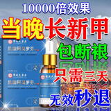 亮甲灰指甲专用灰指甲特效根ii治灰指甲特效第一1名真菌感染脱甲坏甲 药买二送一【一滴长新甲】