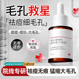 BEAI杏仁酸精华液收缩毛孔粗大去黑头闭口粉刺水杨酸果酸控油祛痘提亮
