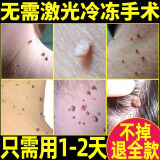 医美霖清赘点痣膏脸部可搭去痣去黑痣美容院专用点痣点疣祛痣膏官方正品 1盒装