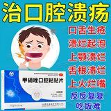 良益 甲硝唑口腔粘贴片5mg*12片/盒嘴唇起泡上火烂嘴角嘴角疱疹粘膜红肿牙龈疼痛牙周炎牙龈萎缩口腔 一盒【口腔溃疡克星】嘴唇起泡上火