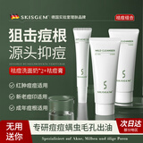 SKISGEM德国进口除螨虫祛痘氨基酸洗面奶控油男女士去黑头缩毛孔洁面乳 洗面奶*2+祛痘膏*1【终极版：全方位除螨祛痘】