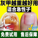 南京同仁堂灰指甲100%特殊效专用抑菌液灰甲净套装35g