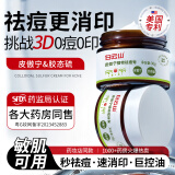 祛痘膏去痘痘和痘疤青春痘学生专用皮傲宁痘印粉刺痘坑修护90g