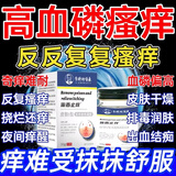 血磷高皮肤痒透析后全身瘙痒老人尿毒症引起止痒膏血液皮肤干燥JY 2盒【浑身皮肤瘙痒】第二盒半价