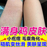 水杨酸软膏 去看角质增生引起的鸡皮肤毛囊角质疙瘩大腿 手臂鸡皮肤疙瘩毛囊角化症专用药毛周角化专用药 3盒装【毛周角化病 鸡皮肤】