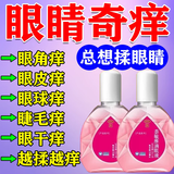 眼药水消炎止痒杀菌干涩疲劳发痒红血丝结膜炎眼睛发炎过敏异物感怕光流泪眼睛疼硫酸锌尿囊素滴眼液 1盒【眼药水消炎止痒杀菌干涩发痒红血丝】